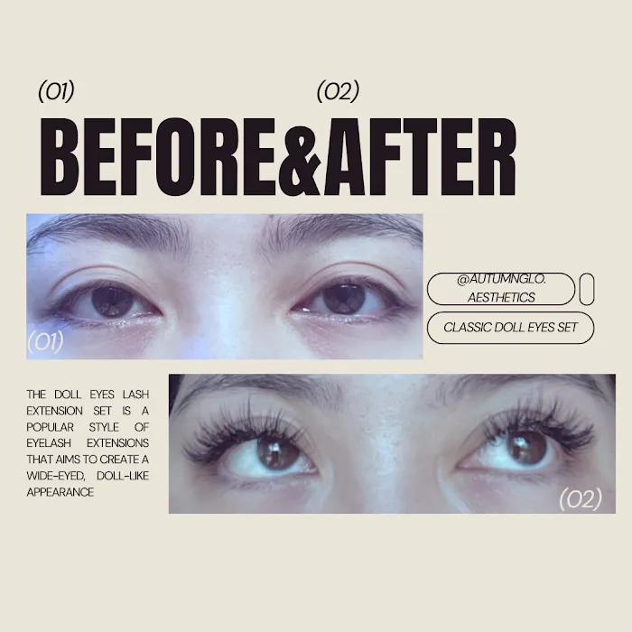 AutumnGlo Aesthetics Picture 2