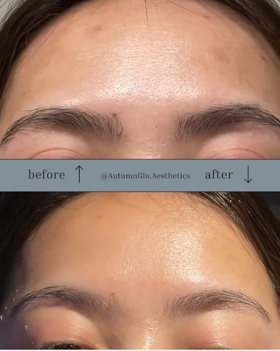 AutumnGlo Aesthetics Picture 5