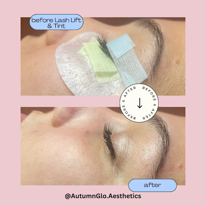 AutumnGlo Aesthetics Picture 4