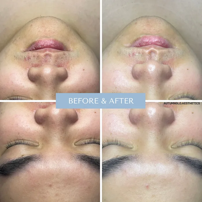 AutumnGlo Aesthetics Picture 7