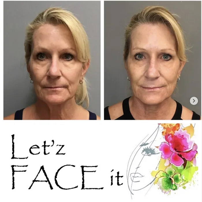 Let'z Face It Picture 9