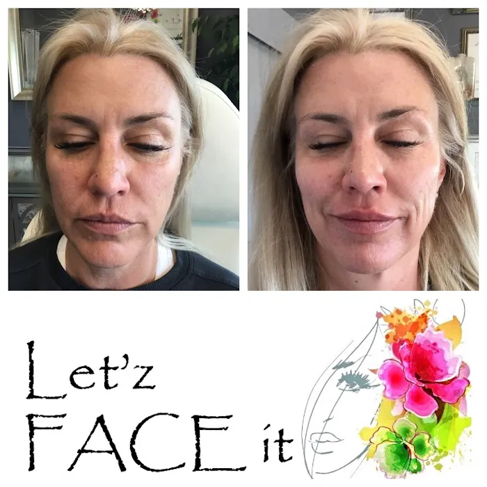 Let'z Face It Picture 10