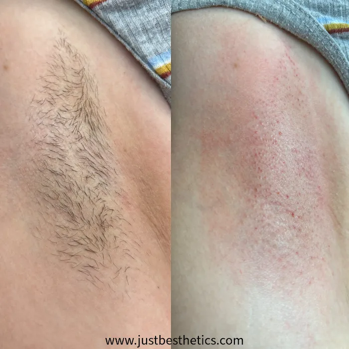 just b esthetics Picture 10