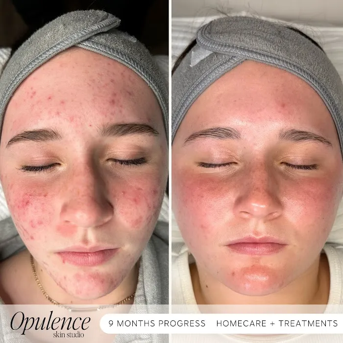 Opulence Skin Studio Picture 4