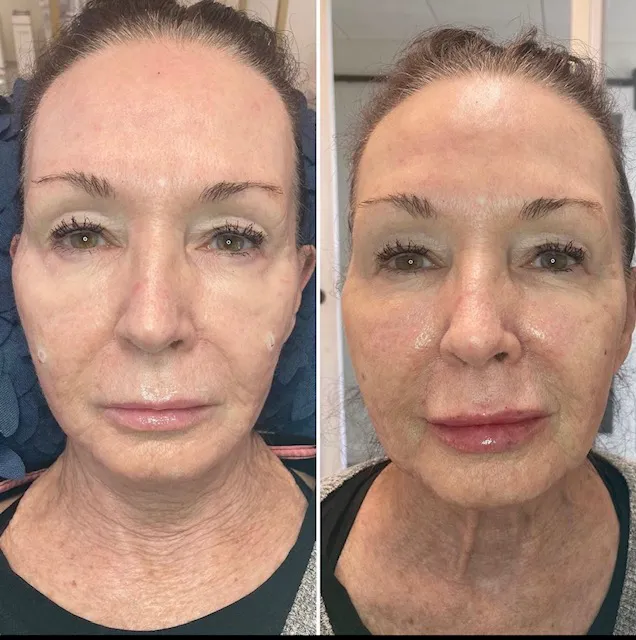 Wallflower Beauty & Wellness LLC Picture 7