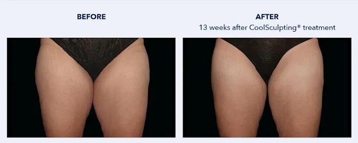 SKINovative Picture 6