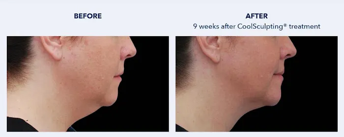 SKINovative Picture 9