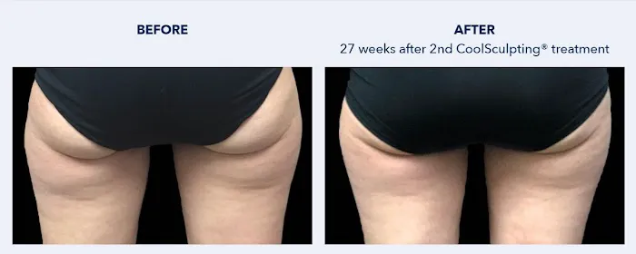 SKINovative Picture 7