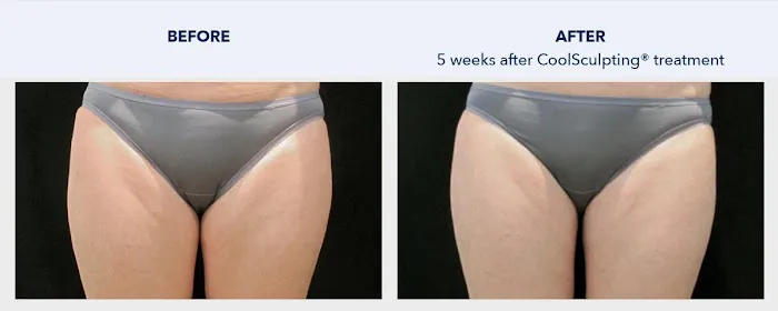 SKINovative Picture 5