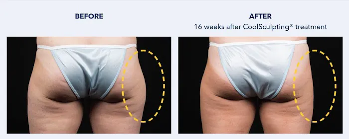 SKINovative Picture 4