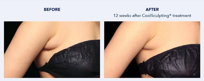 SKINovative Picture 10