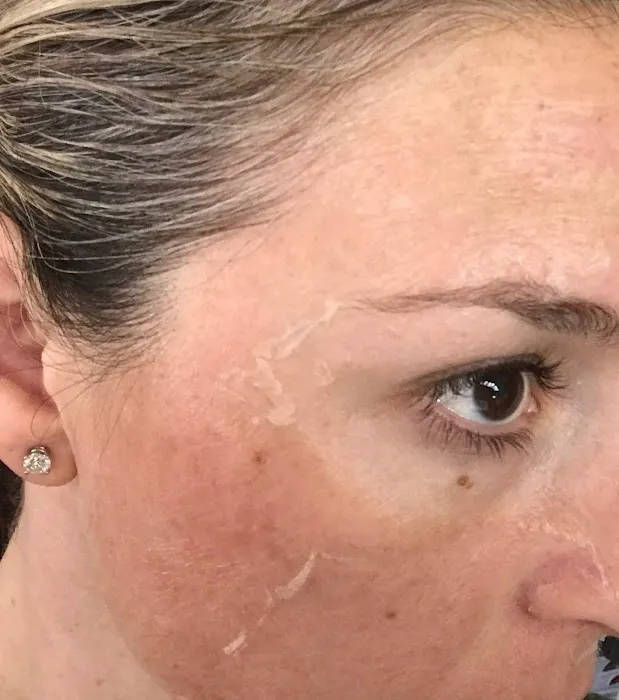 Serendipity Skin Picture 10