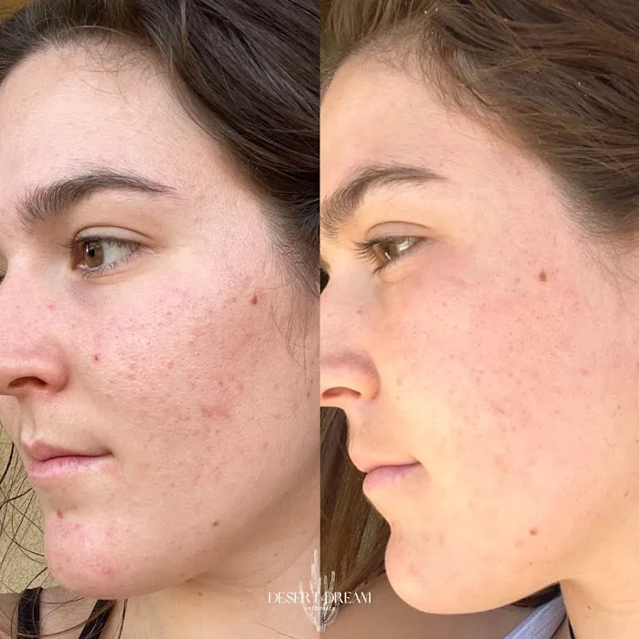 Desert Dream Esthetics Picture 8