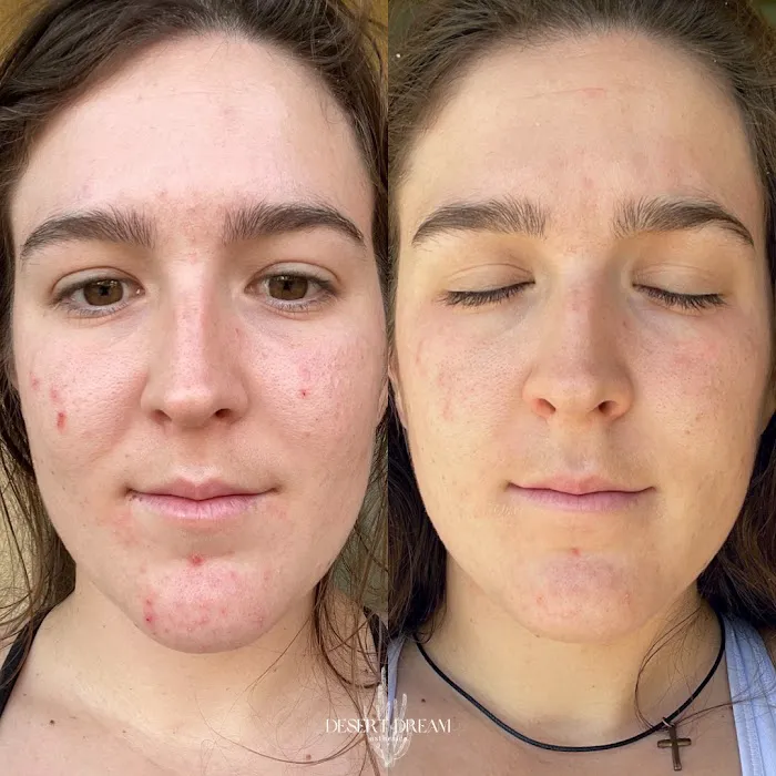 Desert Dream Esthetics Picture 7