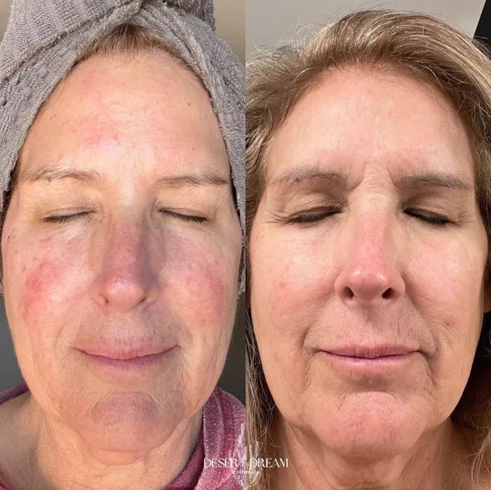 Desert Dream Esthetics Picture 9