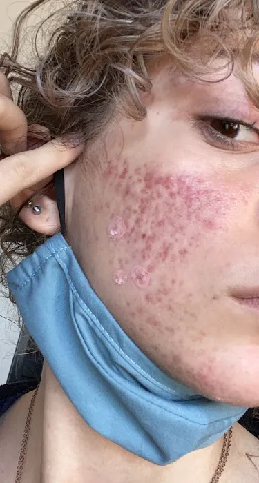 Celebrity Skin Picture 5