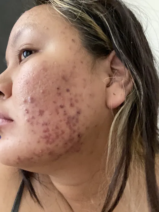 Celebrity Skin Picture 9