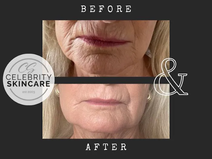 Celebrity Skin Picture 10