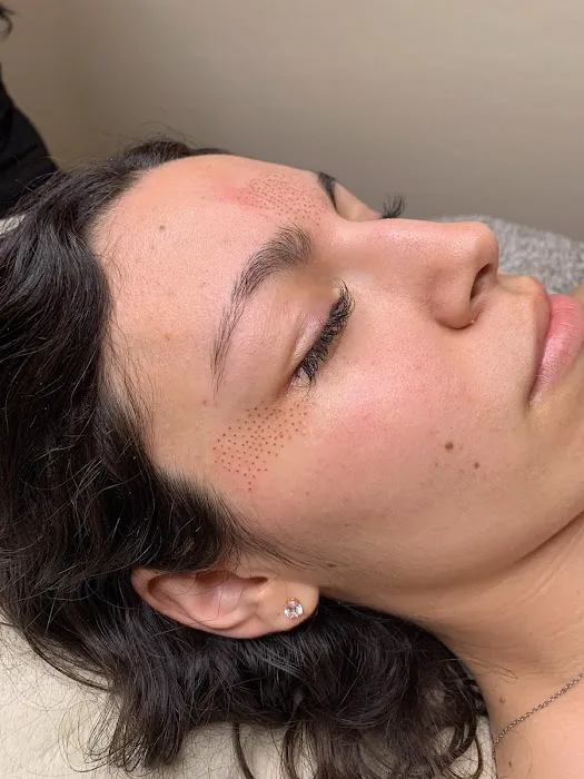 Fibroblast Beauty & Skin by Lisa Villanueva Picture 1