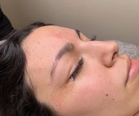 Fibroblast Beauty & Skin by Lisa Villanueva