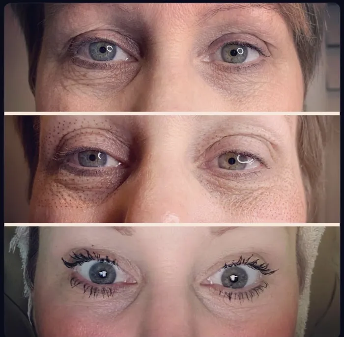 Fibroblast Beauty & Skin by Lisa Villanueva Picture 6