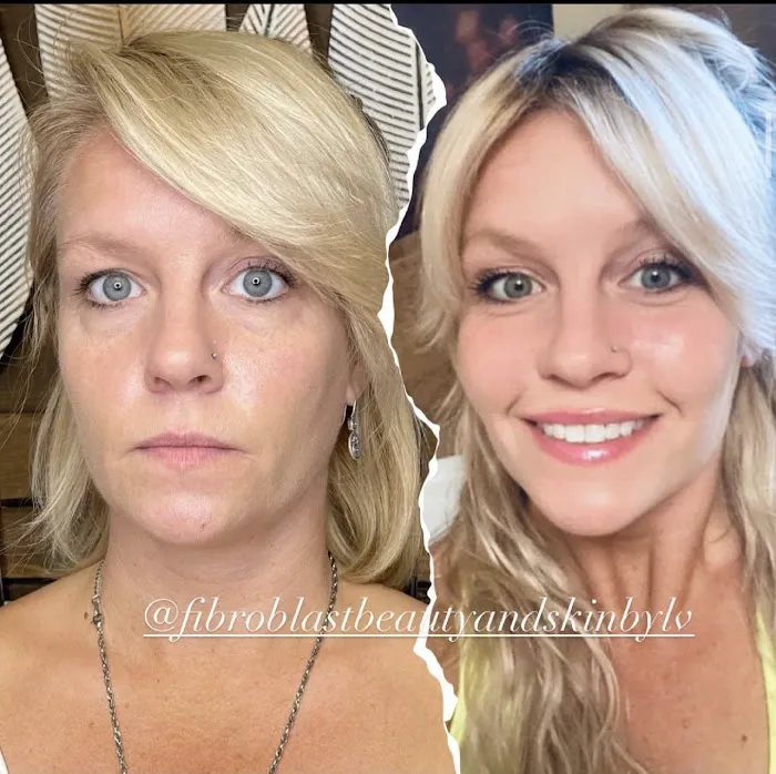 Fibroblast Beauty & Skin by Lisa Villanueva Picture 2