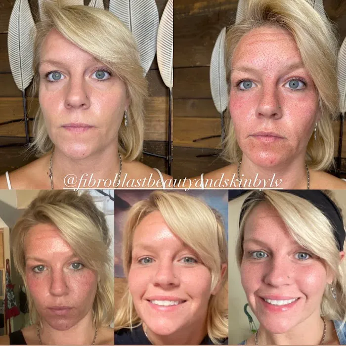 Fibroblast Beauty & Skin by Lisa Villanueva Picture 5