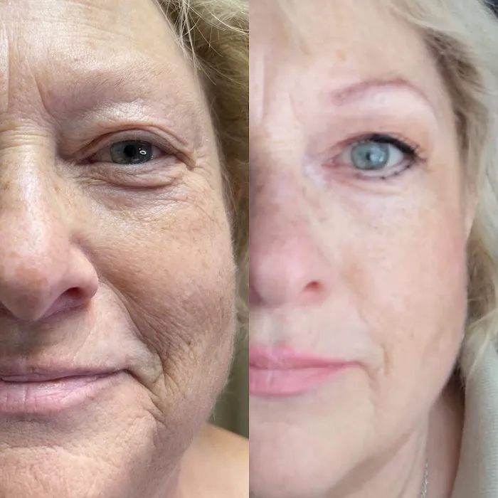 Fibroblast Beauty & Skin by Lisa Villanueva Picture 4