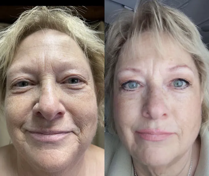 Fibroblast Beauty & Skin by Lisa Villanueva Picture 3