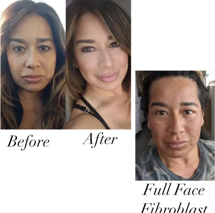 Fibroblast Beauty & Skin by Lisa Villanueva Picture 9