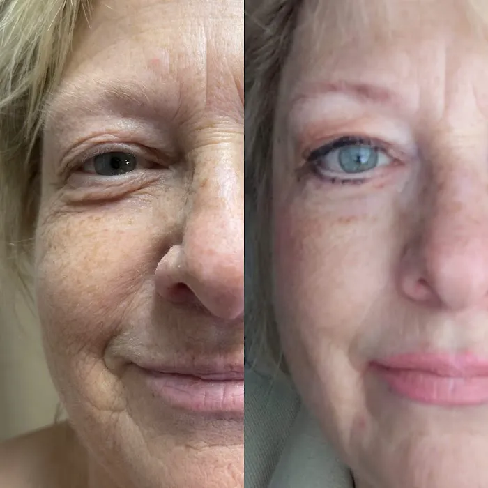 Fibroblast Beauty & Skin by Lisa Villanueva Picture 8