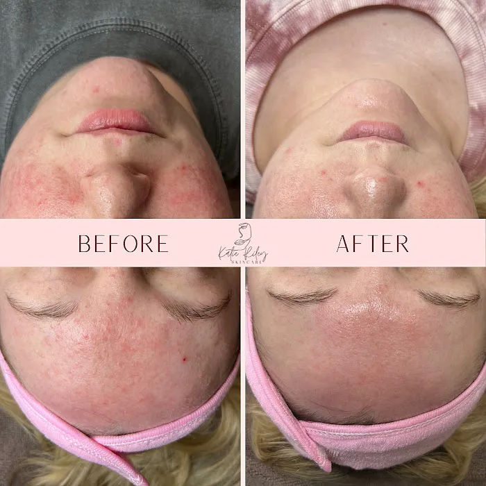 Katie Riley Skincare Picture 3