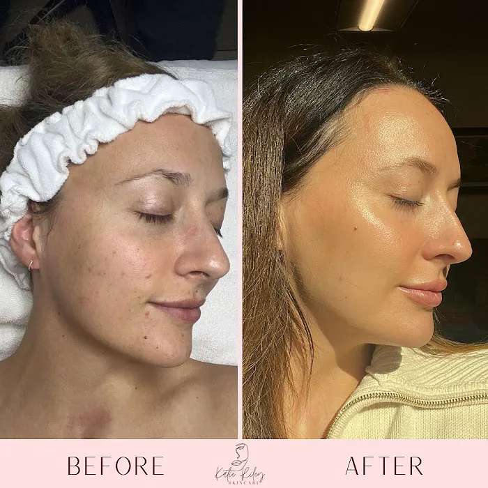 Katie Riley Skincare Picture 2