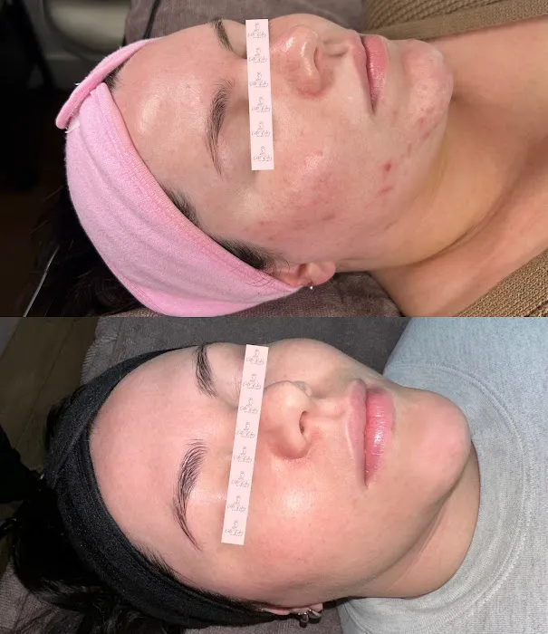 Katie Riley Skincare Picture 1