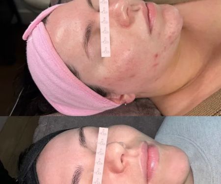 Katie Riley Skincare