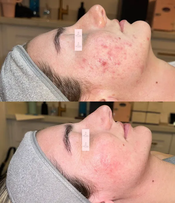 Katie Riley Skincare Picture 5