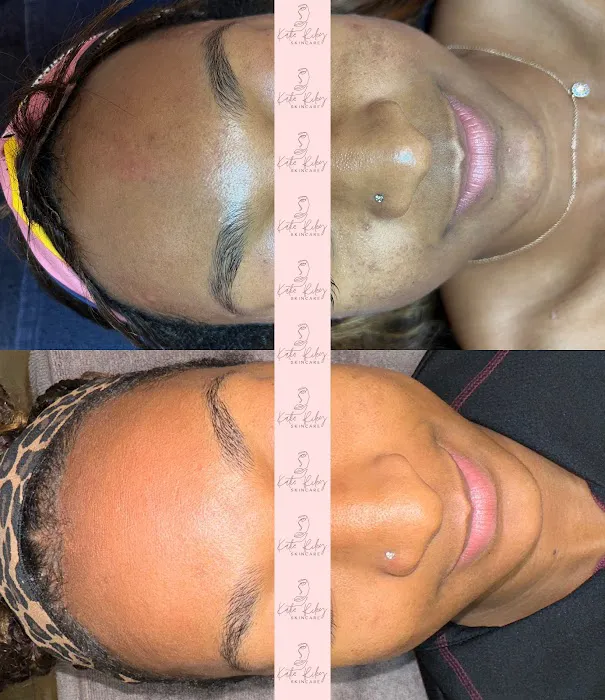 Katie Riley Skincare Picture 4