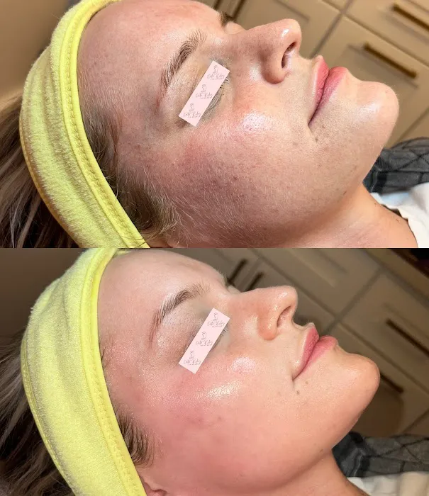 Katie Riley Skincare Picture 9