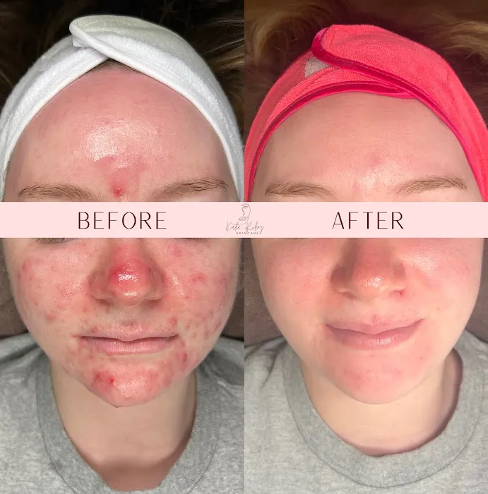 Katie Riley Skincare Picture 8