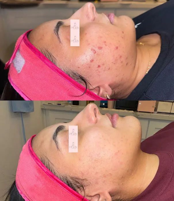 Katie Riley Skincare Picture 10