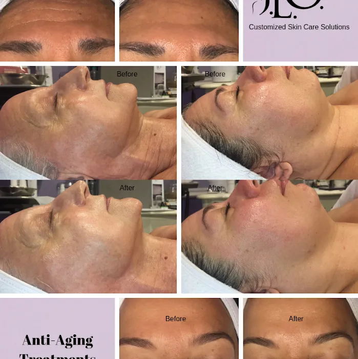 Butterfly Method Skincare Picture 8