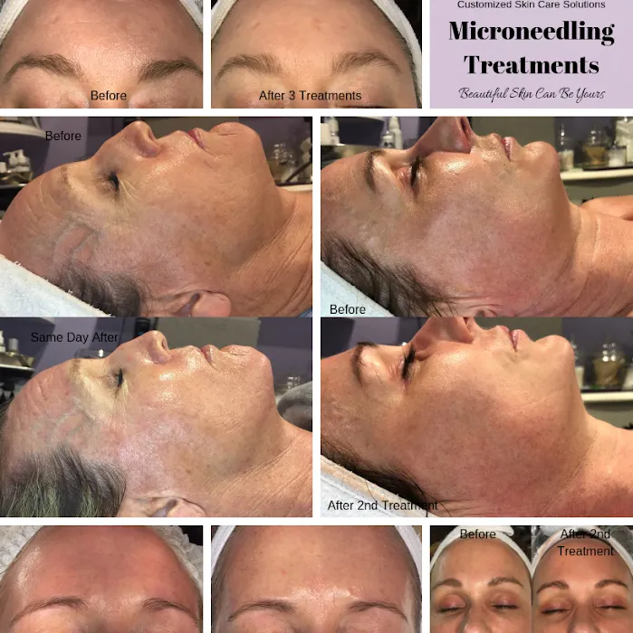 Butterfly Method Skincare Picture 9