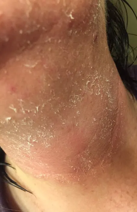 Butterfly Method Skincare Picture 10