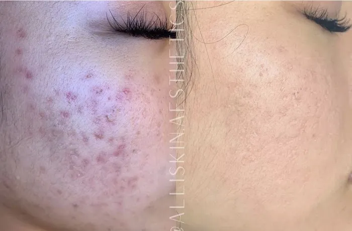 Revive Skin Bar Picture 7