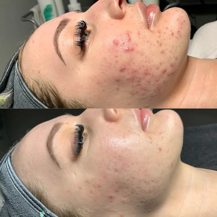 Revive Skin Bar Picture 6