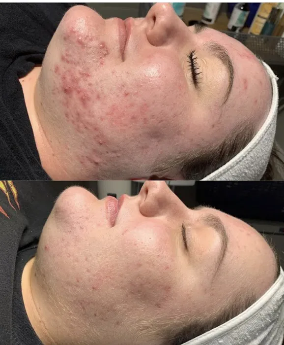 Revive Skin Bar Picture 4