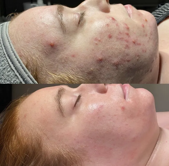 Revive Skin Bar Picture 10