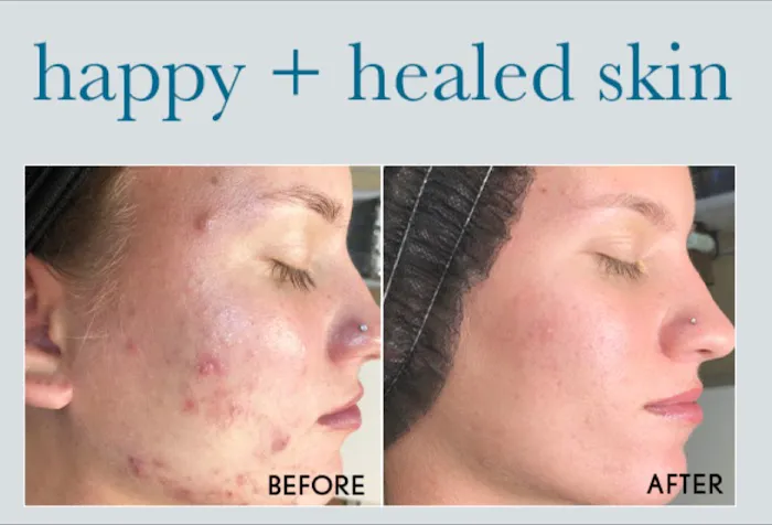 SkinLove Aesthetics Picture 4