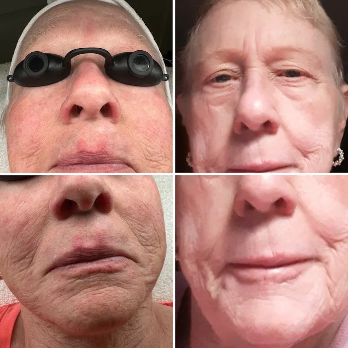 SkinLove Aesthetics Picture 8