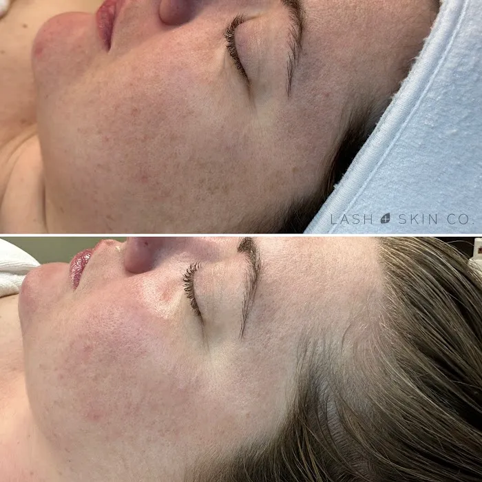 SkinLove Aesthetics Picture 7